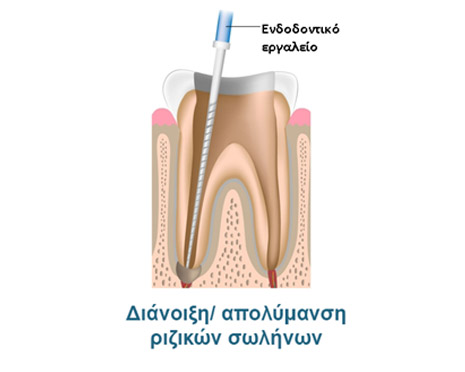 aponeurosi 2