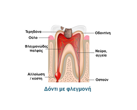 aponeurosi 1